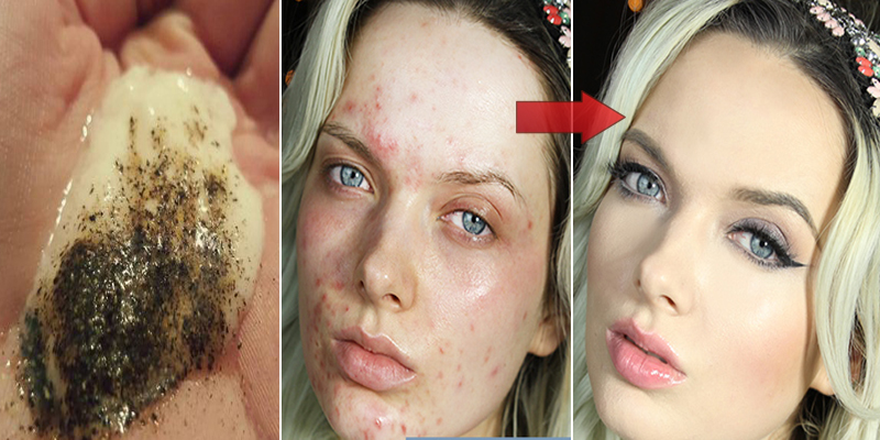 Mix These 2 Ingredients and See What Happens To Your Skin After Several Minutes