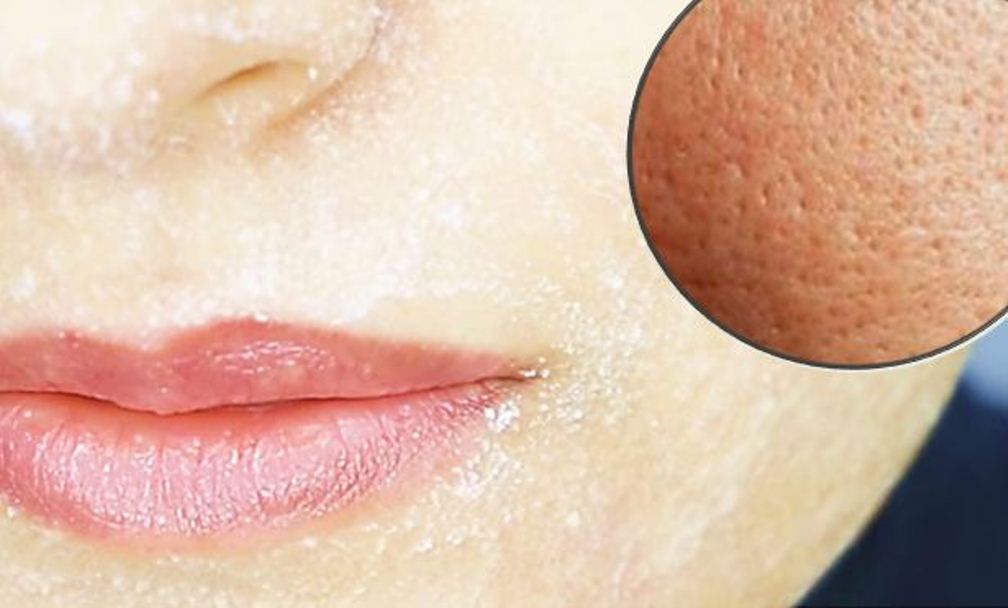 This Is the Only Ingredient You Will Need to Shrink Your Pores