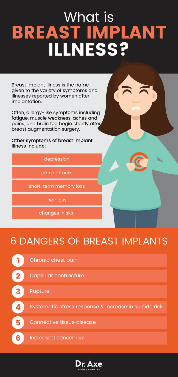 Breast-Implant-Graphic