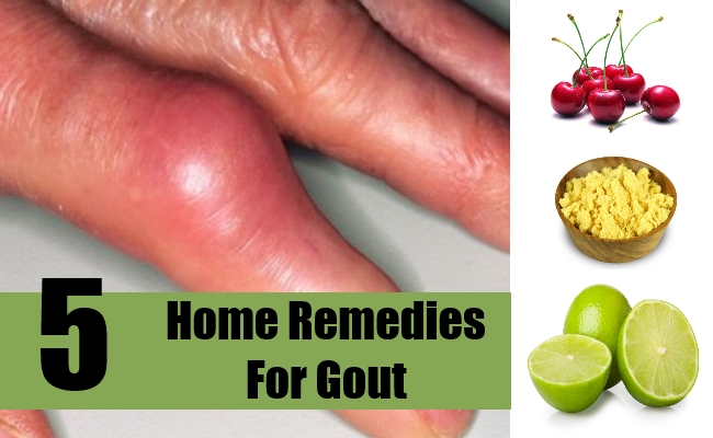 Top Home Remedies For Gout