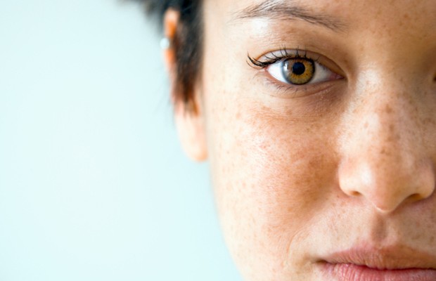 How To Get Rid Of Brown Spots On Skin?