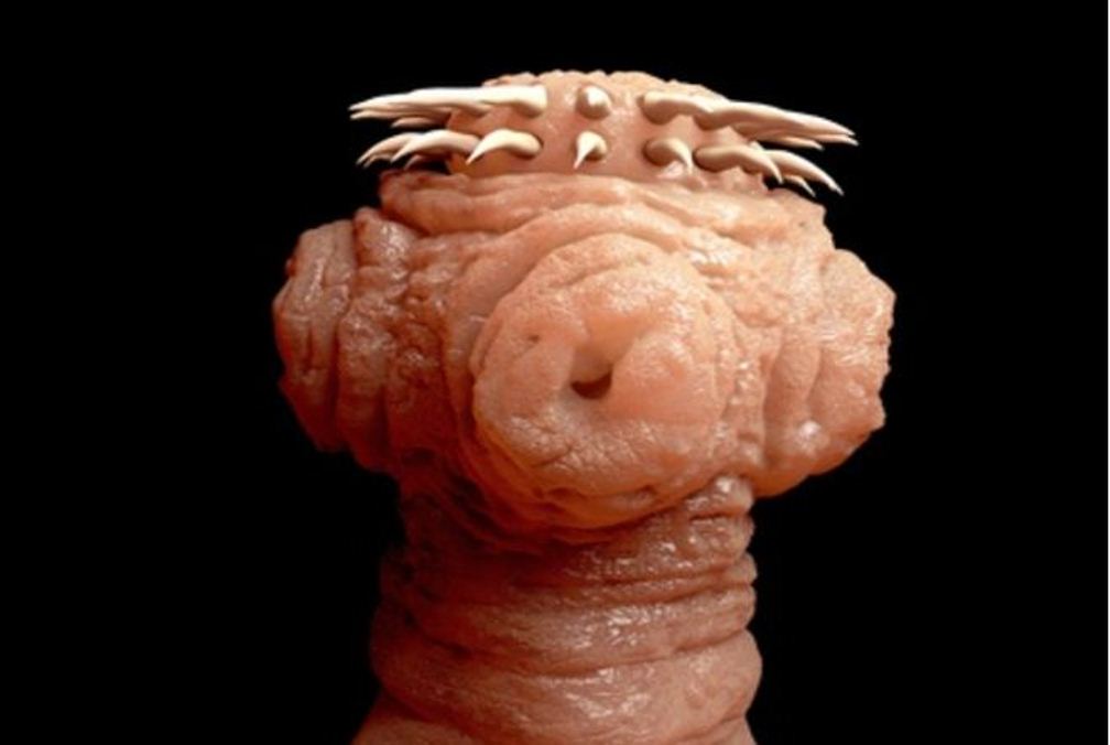 BREAKING: Worms Can Grow Inside You and Invade Your Body From Eating THIS Common Food!