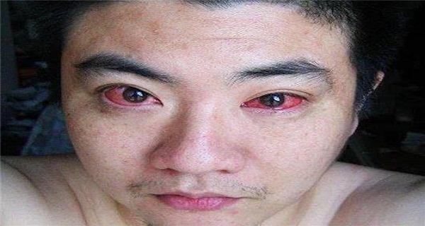 MAN DIAGNOSED WITH EYE CANCER BECAUSE OF DOING THIS AT NIGHT!