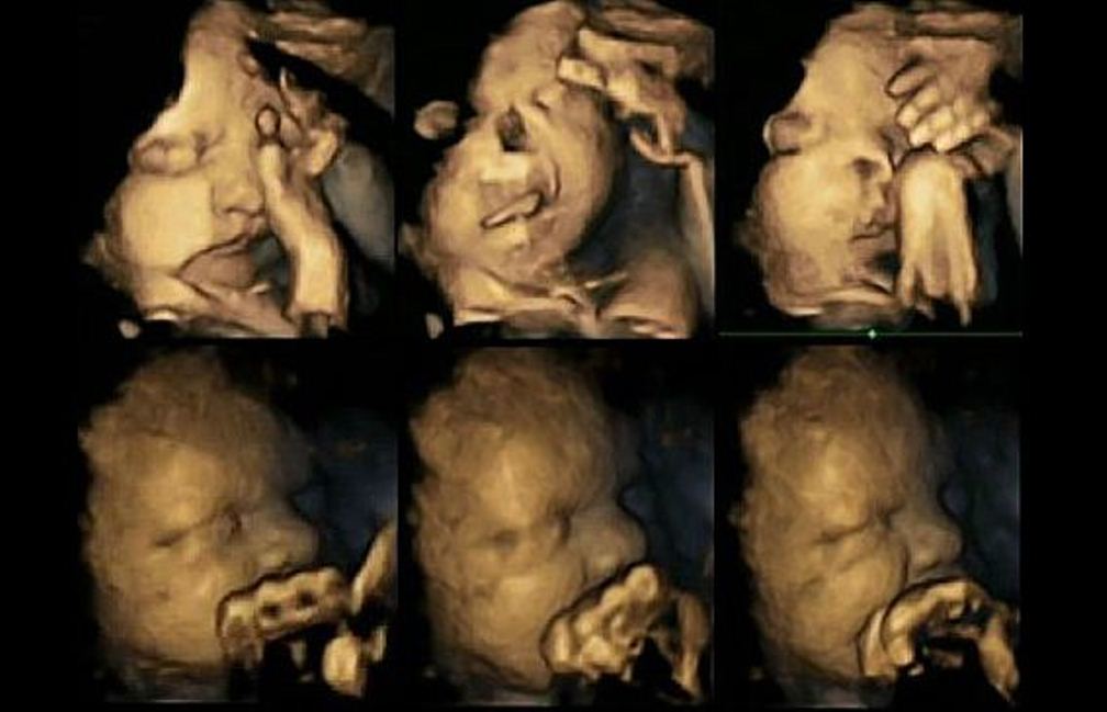 Unborn Babies ”Grimacing” and ”Suffering” In the Womb as Their Mothers Smoked Cigarettes. This Will Make You Thing Twice Before You Light Up Again!