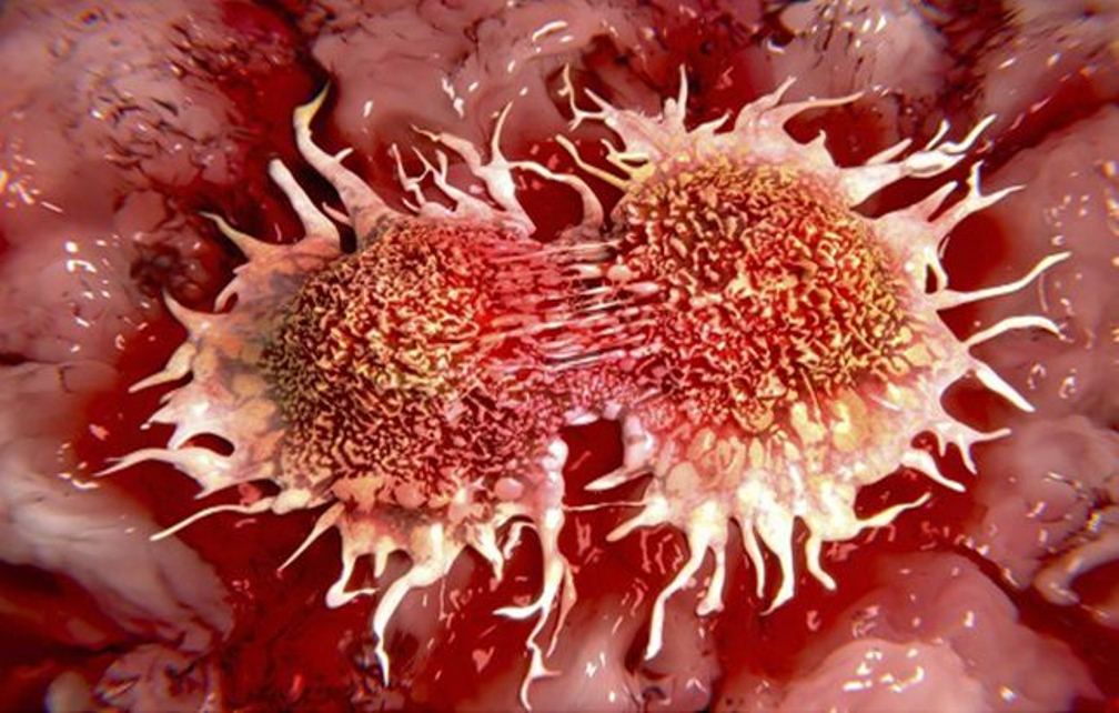 WHY IS THIS HIDDEN FROM THE PUBLIC: Top 10 Causes of Cancer That We Use Daily!