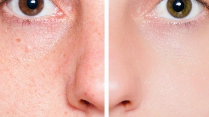 This Is the Only Ingredient You Will Need to Shrink Your Pores